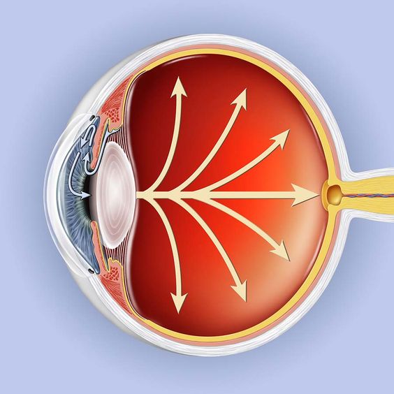 Glaucoma: Symptoms, Treatment, and Management